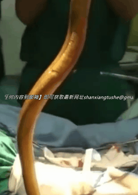 图片[5]-【特殊资源】当年火遍全网的黄鳝门事件，相信大家都看过了-91欢迎您！